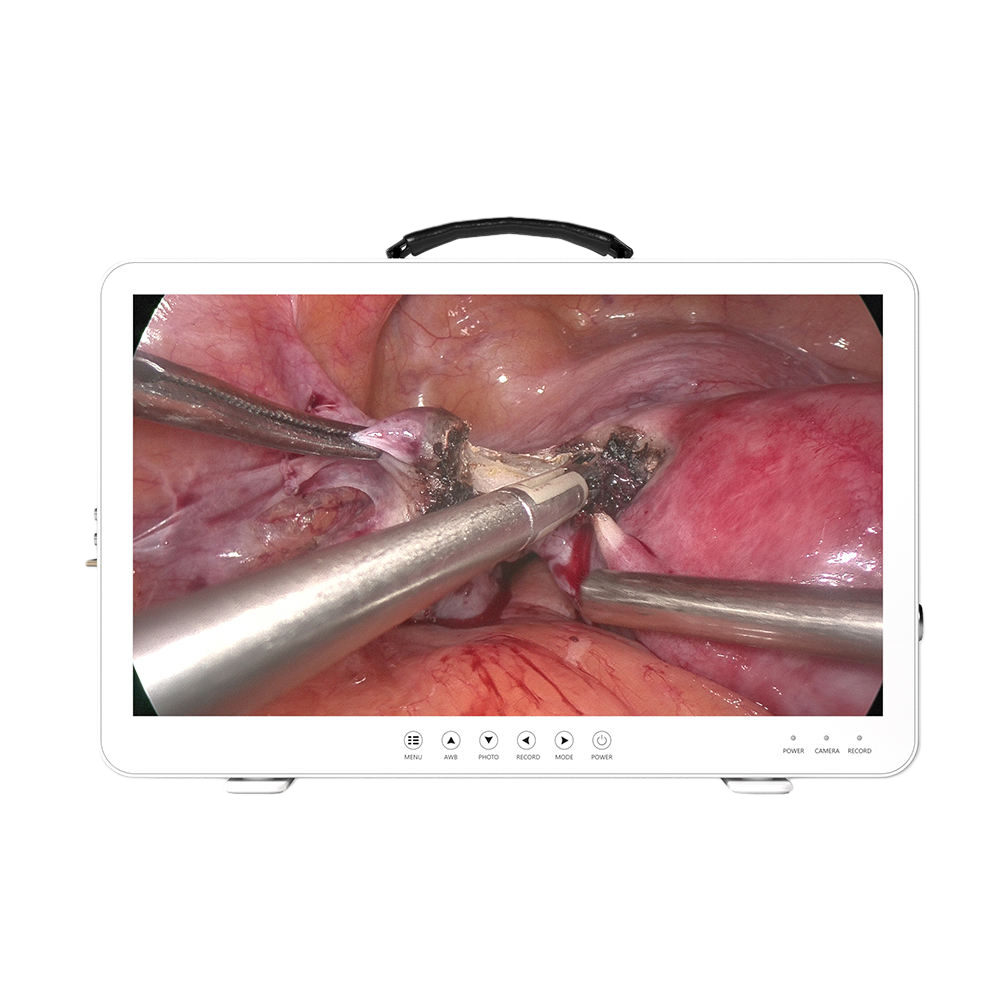 便捷式一体化内窥镜摄像系统 - 图3